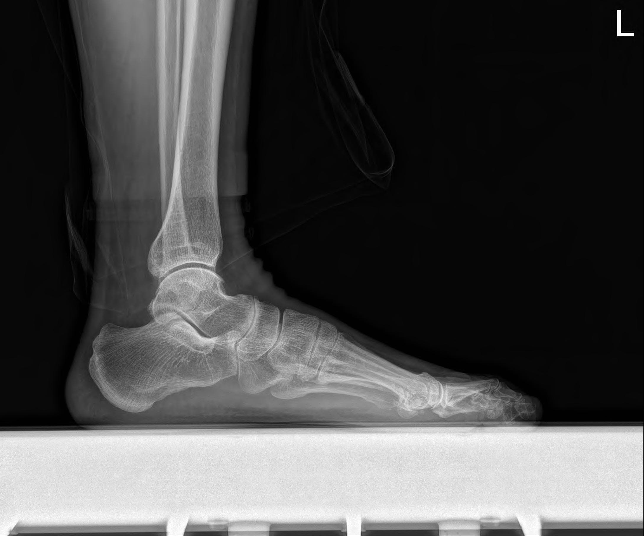 Foot LAT 원본