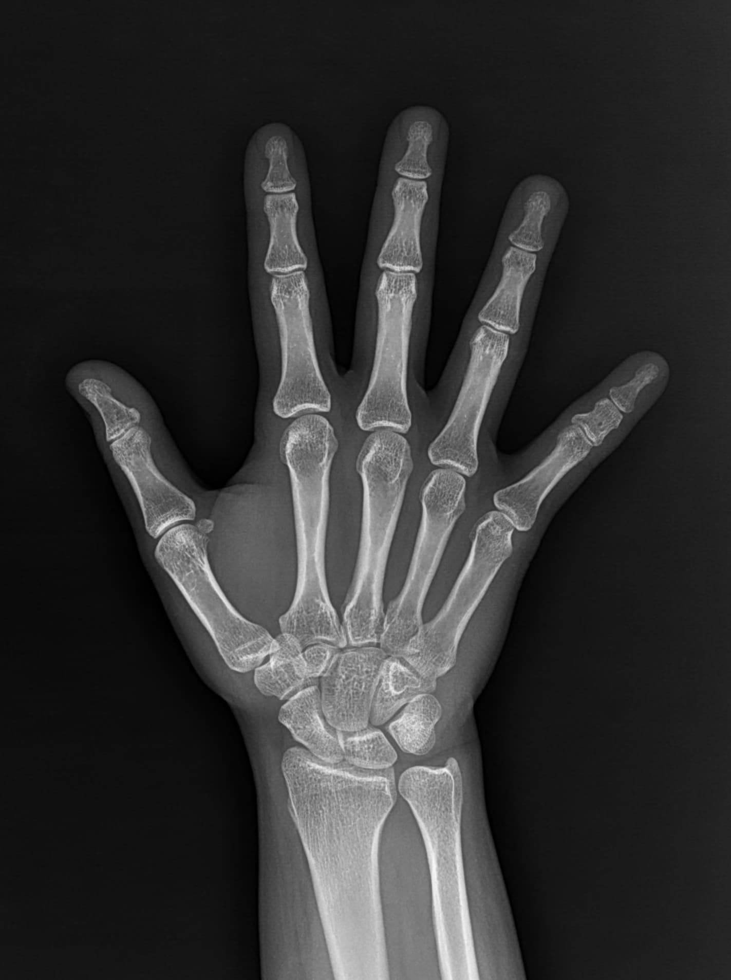 Hand AP 원본