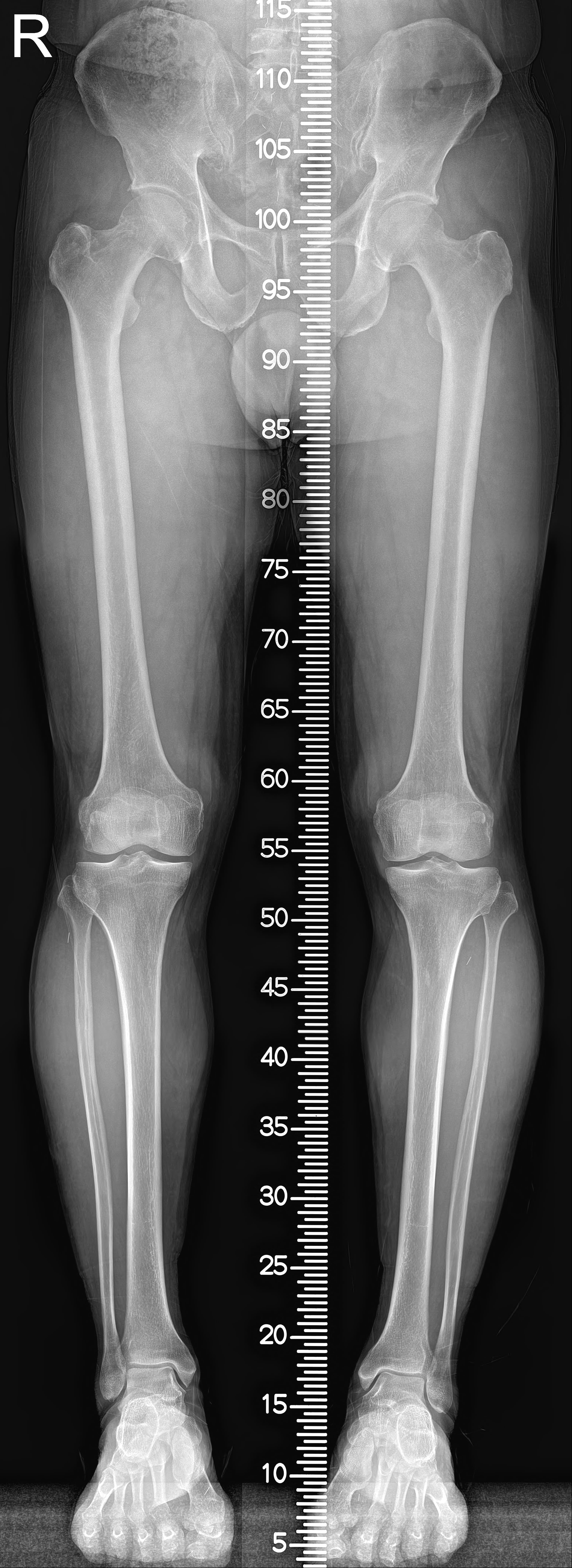 Scanogram 원본