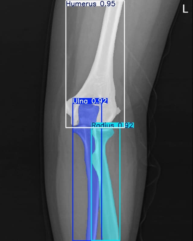 Elbow AP 결과