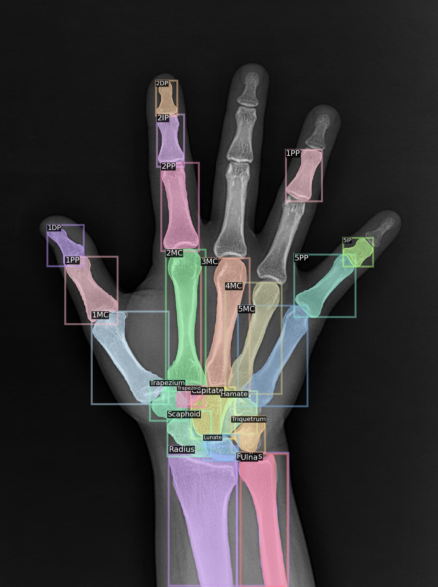 Hand AP 결과
